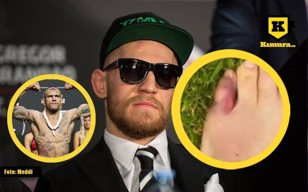 Pereira om McGregor's skada